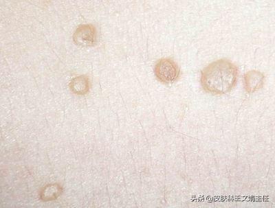 新澳门精准免费大全，详细解答、全面解答解释落实
